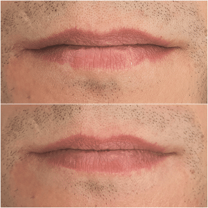 férfi szájtetoválás a Patkós Alexandra Exclusive Beauty Szalonban
