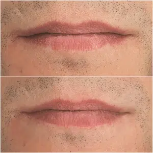 férfi szájtetoválás a Patkós Alexandra Exclusive Beauty Szalonban