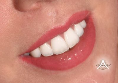 Ajaktetoválás a Patkós Alexandra Exclusive Beauty szalonban