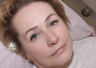 Gyógyult szálas szemöldöktetoválás a Patkós Alexandra Exclusive Beauty szalonban